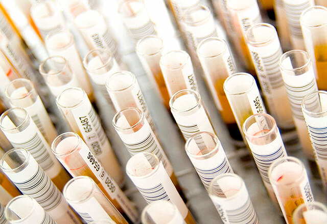 clinical samples in tubes