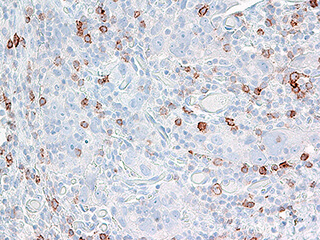 pathology cells