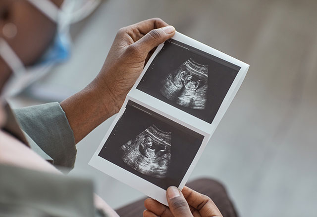 woman holds ultrasound picture