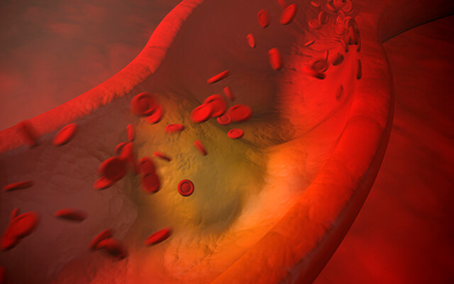 cardiovascular research - heart failure image