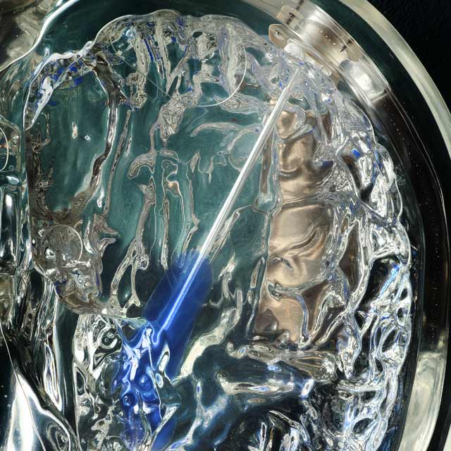 A neurostimulator inside a glass skull