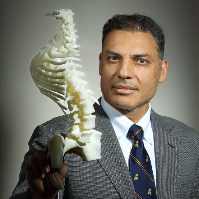 Photo shows Khaled Kebaish, M.B.B.Ch., holding a 3-D “before” model of the spine of a 50-year-old woman with severe spinal kyphosis. The patient underwent a complex vertebral column resection in which six vertebral segments were removed.
