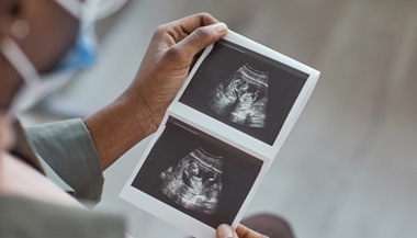 Expecting parent holding fetal ultrasound images