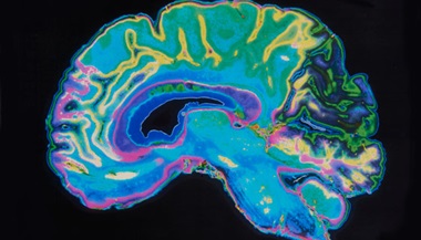 Image of a brain scan with a black background