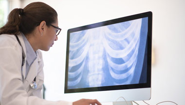Radiologist examines a chest x-ray