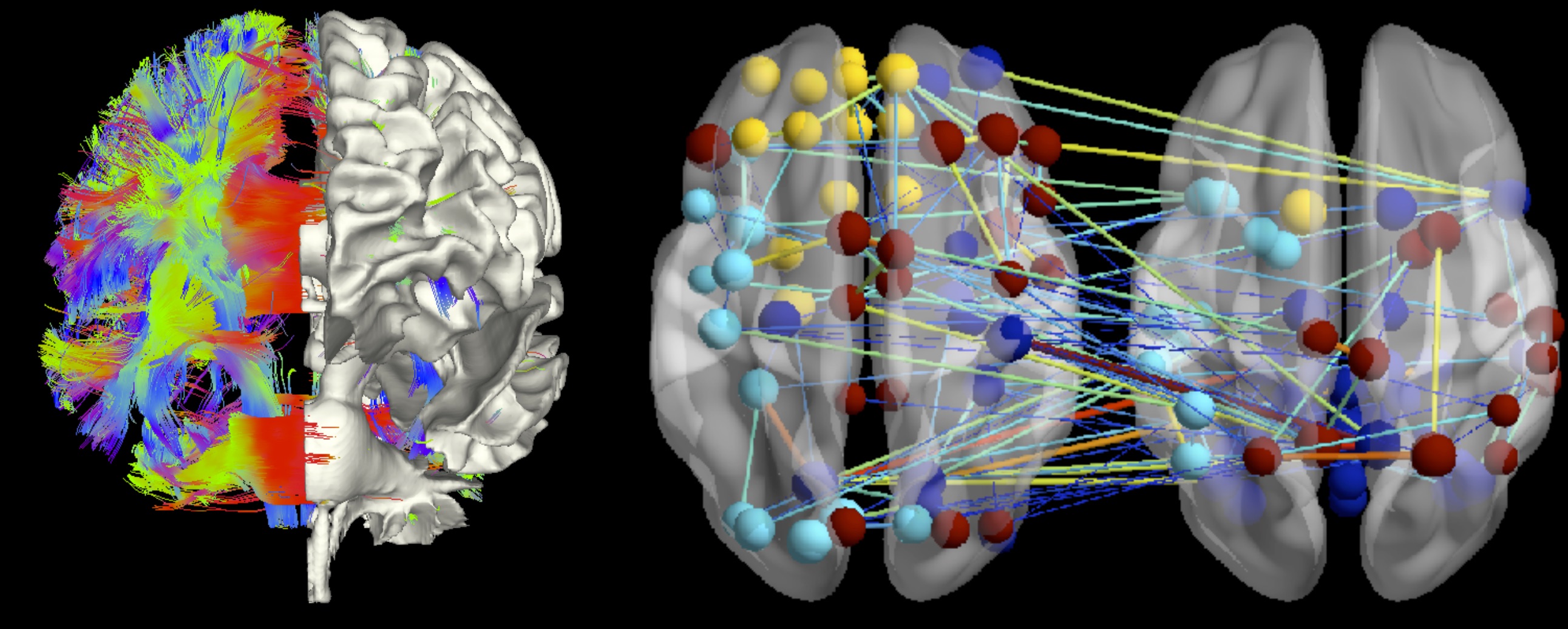 Networks in anatomical space: structural connectome, a graphical model of a brain network