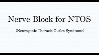 Nerve Block Treatment for Thoracic Outlet Syndrome TOS
