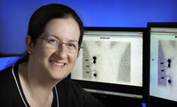 Not every melanoma patient needs a sentinel node biopsy, says Julie Lange. 