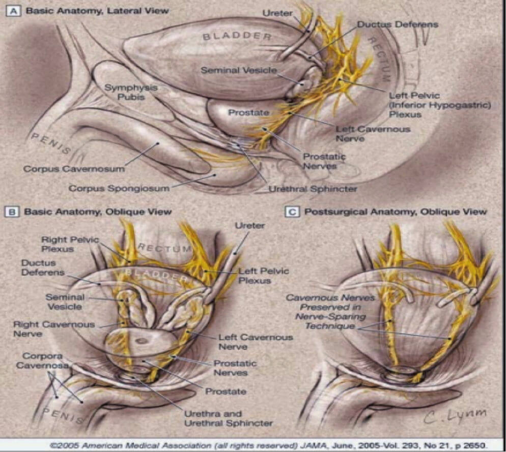 Anatomy of the prostate and other pelvic structures