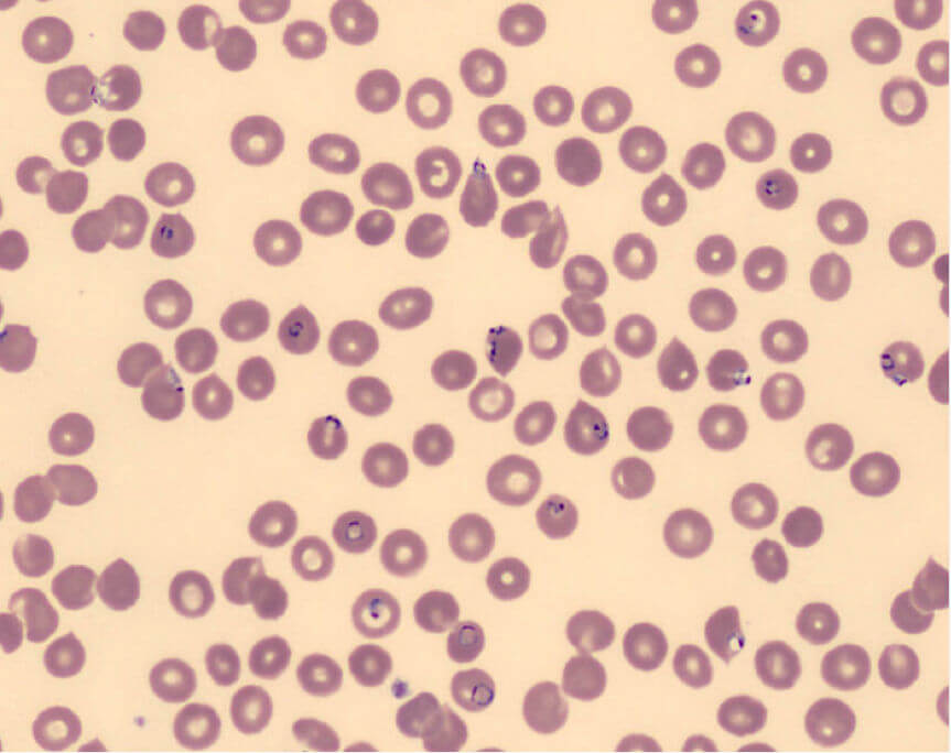 Slide showing Malaria parasite inside red blood cells.