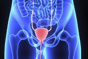 Medical depiction of ureter obstruction