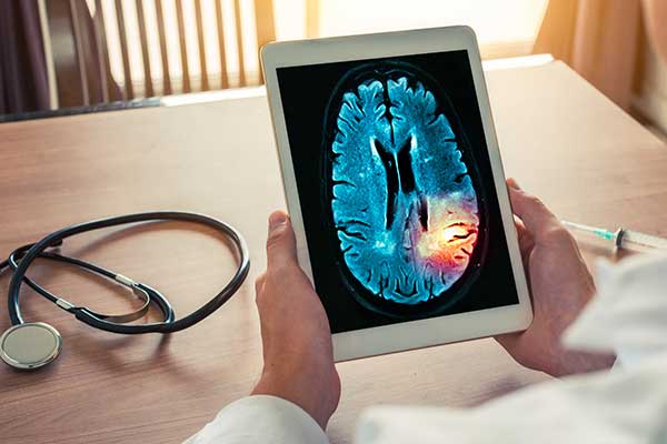 Doctor examines brain lesion on a tablet