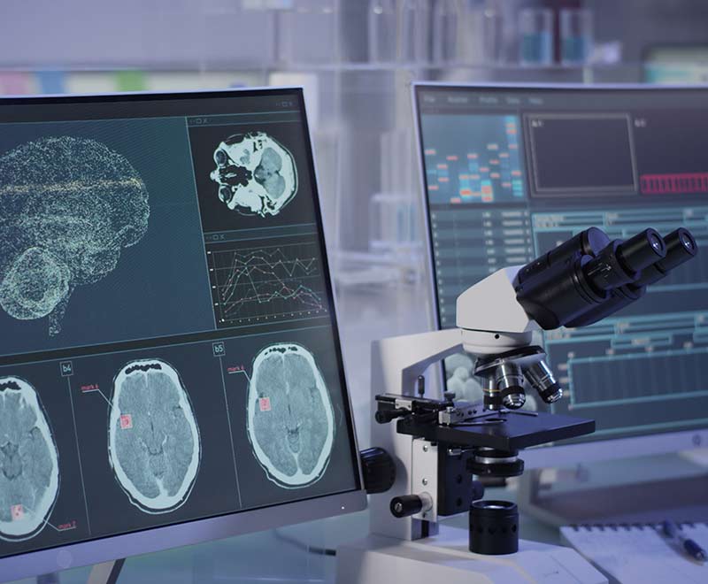 Microscope and computer screen with brain tumor scans
