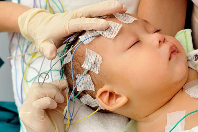 A baby undergoes an EEG test