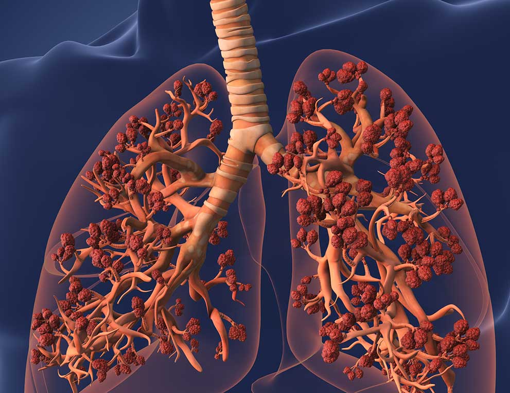 Illustration of the lungs