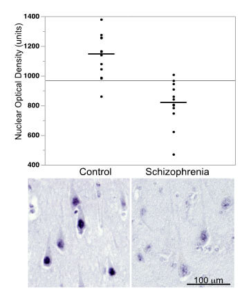 SREBP in postmortem brain from Schizophrenia patients