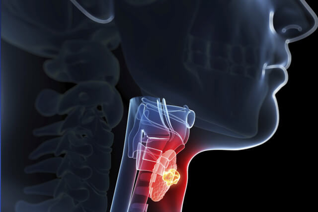 Anatomical image of thyroid