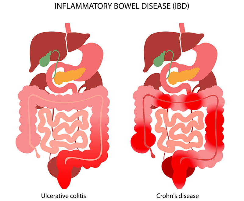 Intestines graphic