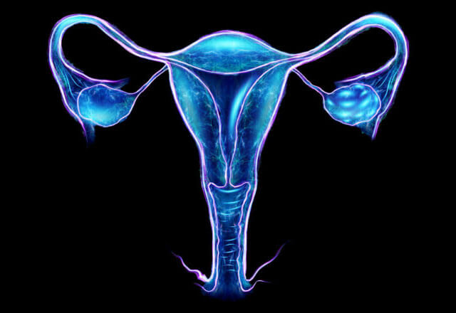 Intercepting Ovarian Cancer Featured Slide 2