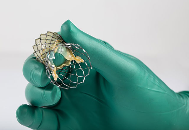 a green gloved hand holds an artificial heart valve