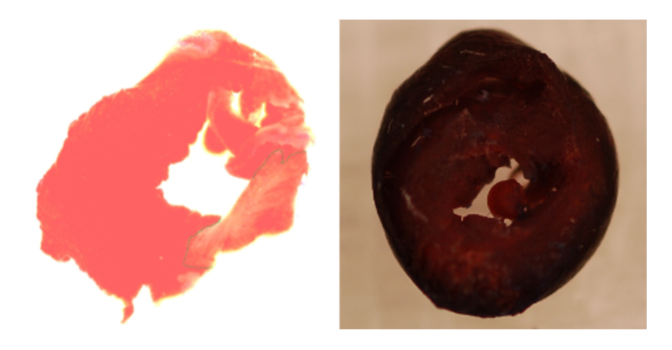 cardiac surgery research - image of heart slice demonstrating infarct from porcine model