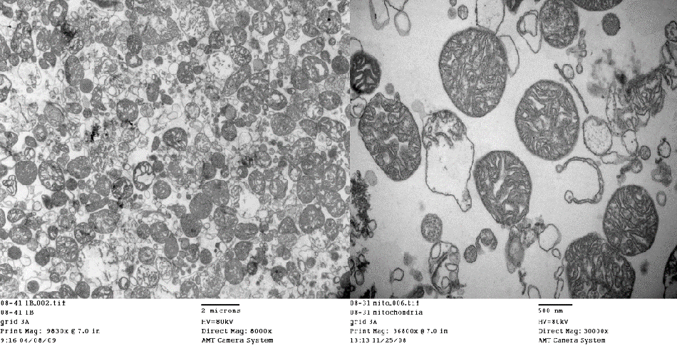 cardiac surgery research - image of isolated mitochondria