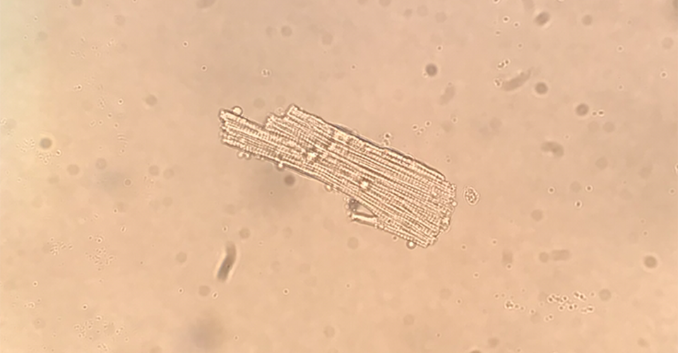 cardiac surgery research - isolated myocyte