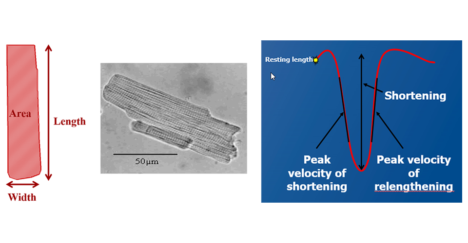 cardiac surgery research - Diagram explaining Myocyte Volume and Contractility
