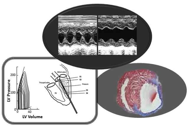 heart function and geometry by ultrasound and doppler imaging