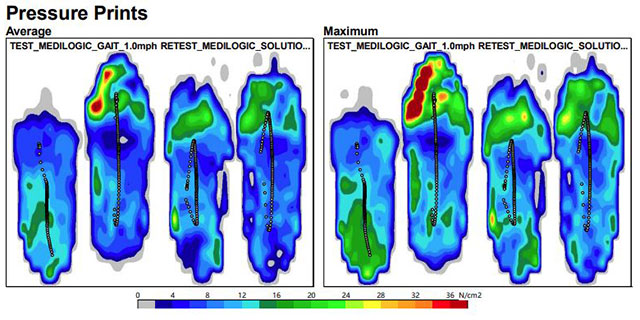 gait analysis