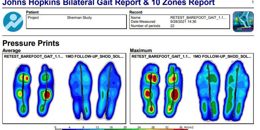 gait analysis