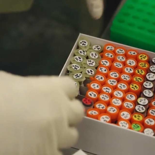 Liquid biopsy lab samples