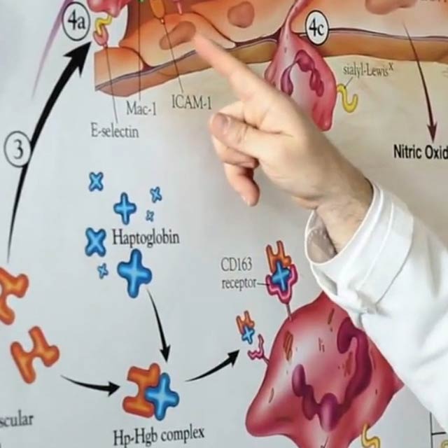 Subarachnoid hemorrhage