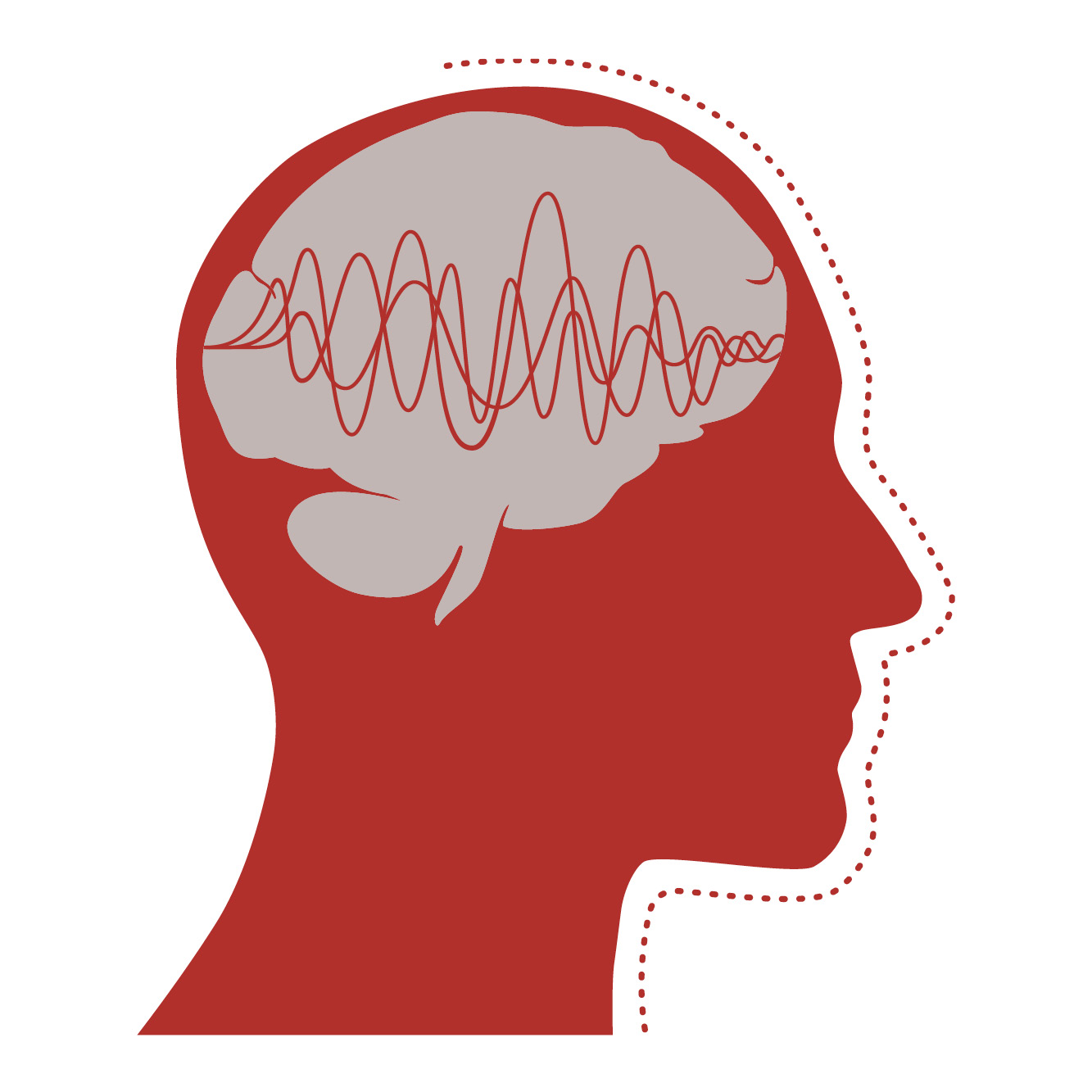 Is It a Concussion or Something Else? | Johns Hopkins Medicine