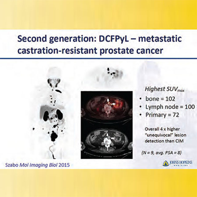 Second generation: DCFPyL - metastatic castration-resistant prostate cancer