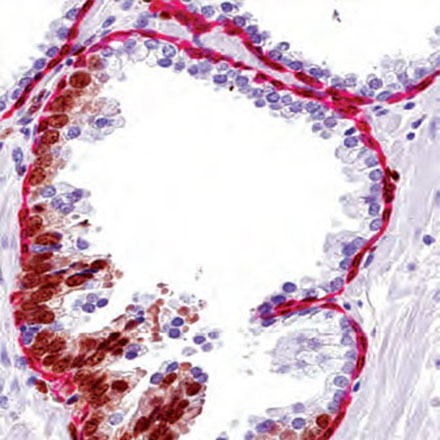 Bright cells shown in high magnification