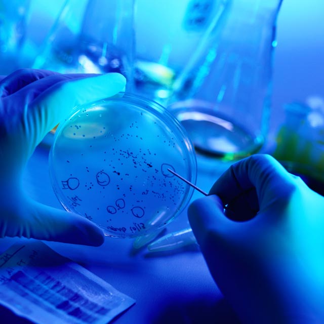 Petri-Dish-blue-color