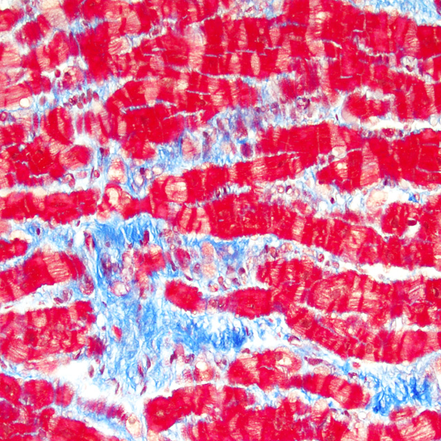 Pulse_Web_Spring16_cardiac cells