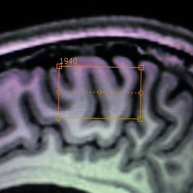 RES1701026_LR_Restore_Spring 2017 WEB sensorimotor cortex