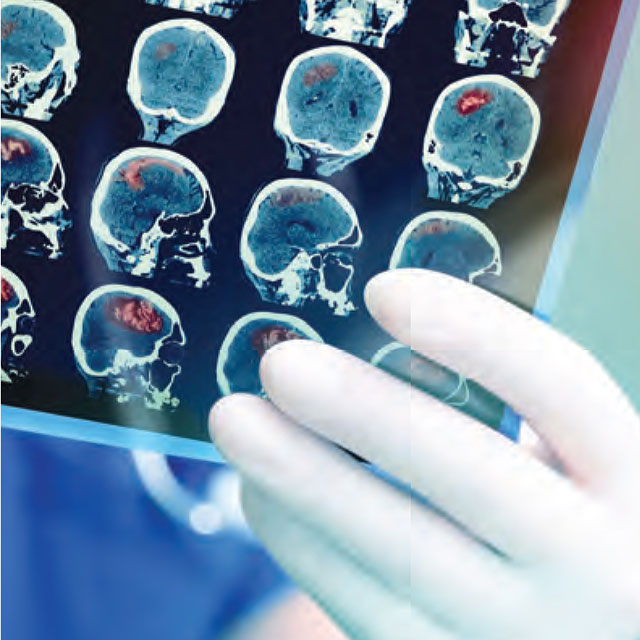 Close up of a brain images being reviewed