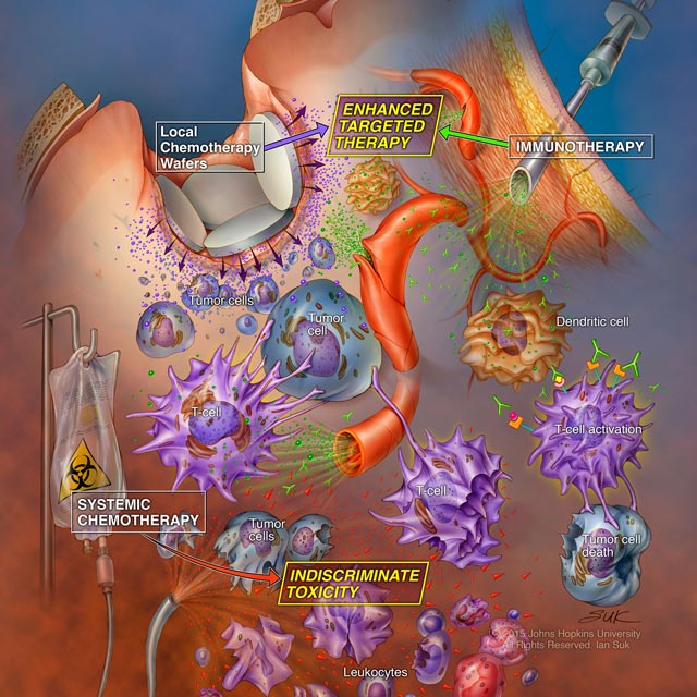 Illustration of the concept of optimizing chemotherapy in the setting of immunotherapy.