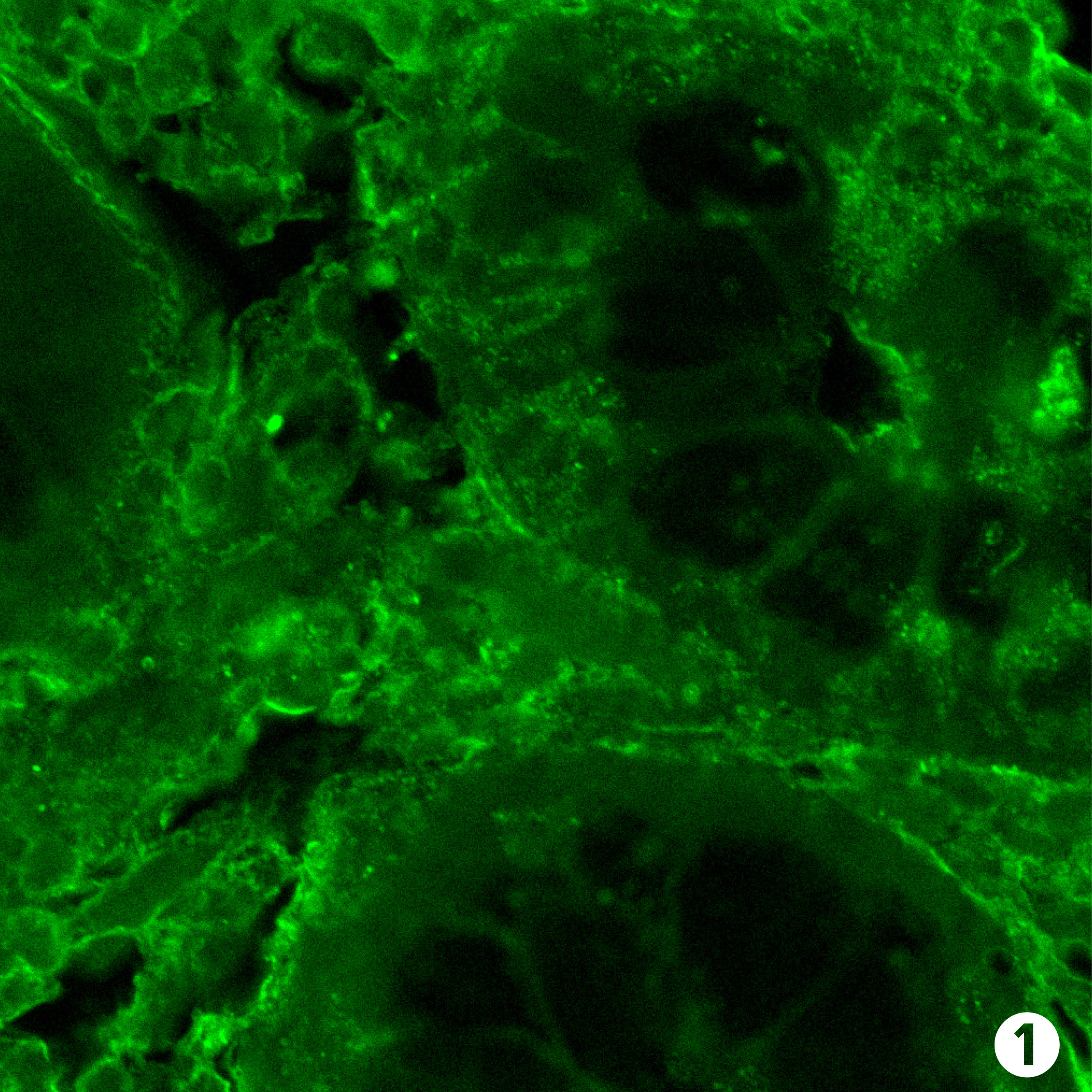 Side by side genetics IBD
