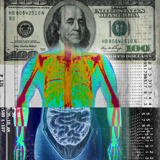 Artist's illustration combines radiological images with a $100 bill.