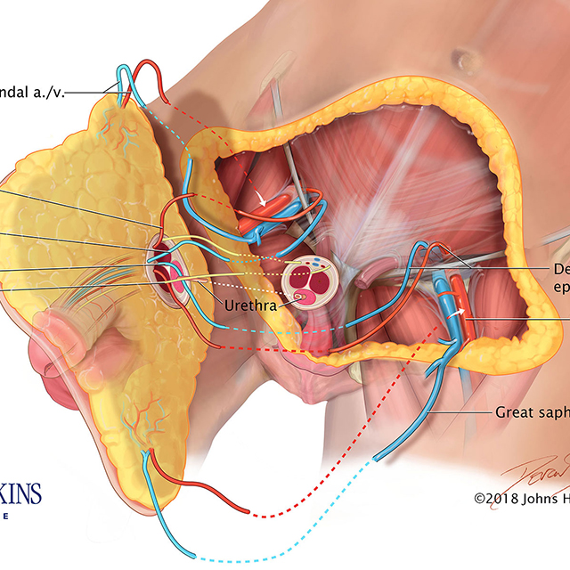 First-Ever Penis and Scrotum Transplant Make History at Johns Hopkins_edit