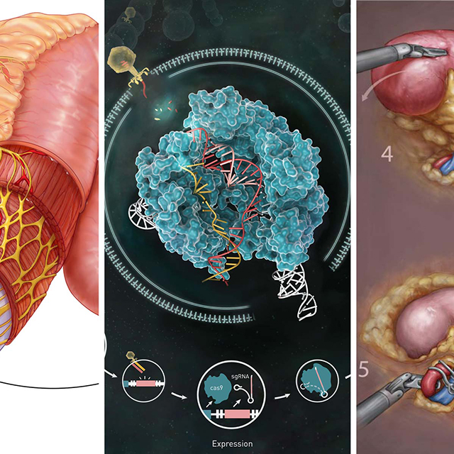 Medical Illustration Exhibit Showcases Students Talent_edit