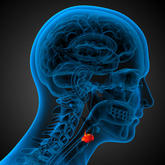LARYNGEAL-CANCER-IMAGE-640