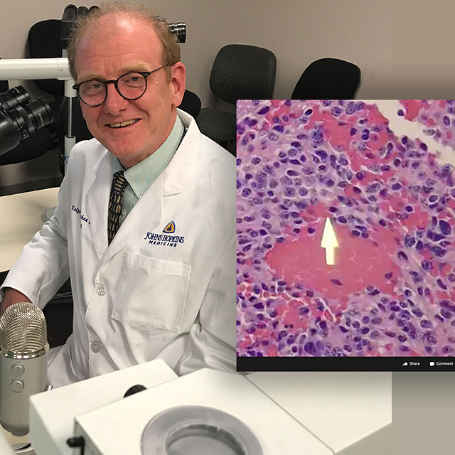 Live from The Johns Hopkins Hospital Welcome to pathCast_edit