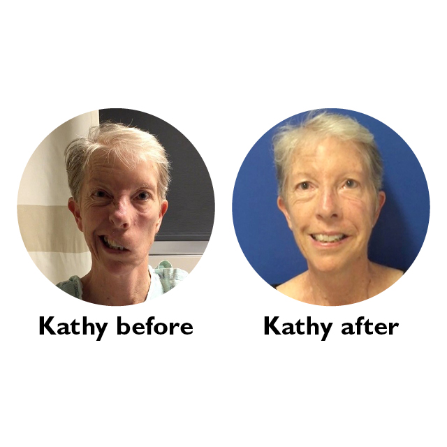 Patient kathy