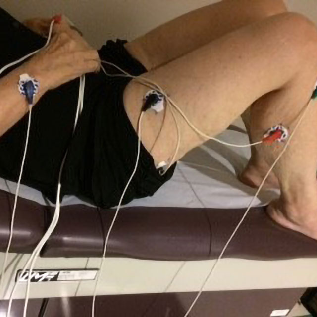 A photo shows electrodes attached to a person.
