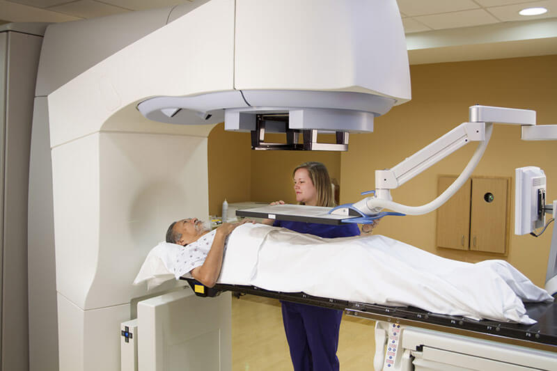 bladder cancer